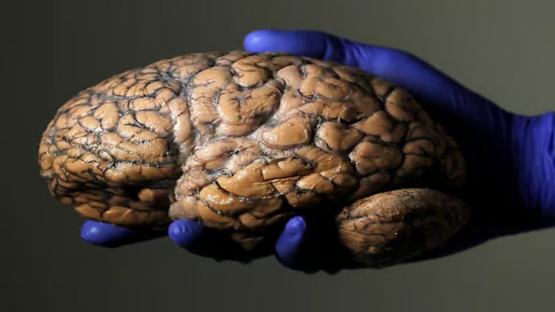 মস্তিষ্কের বয়স বৃদ্ধি পায় পাঁচ ধাপে: জীবনের প্রতিটি পর্যায়ে